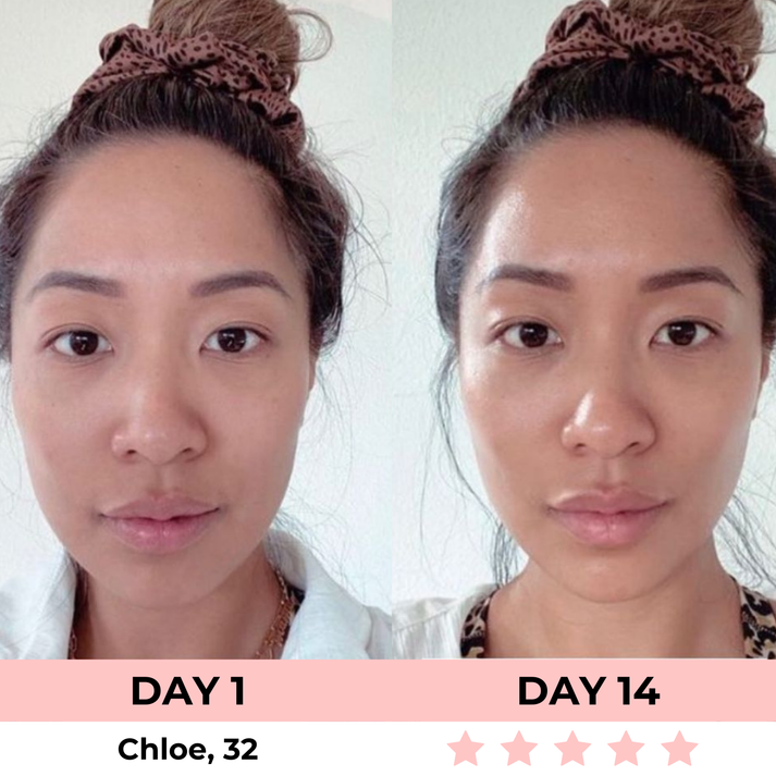 KC™ 7-in-1 LED Facial Sculptor
