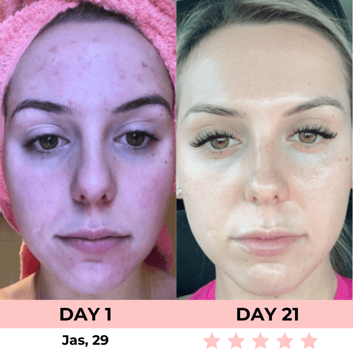 KC™ 7-in-1 LED Facial Sculptor