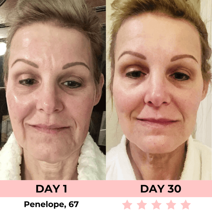 KC™ 7-in-1 LED Facial Sculptor