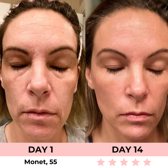 KC™ 7-in-1 LED Facial Sculptor