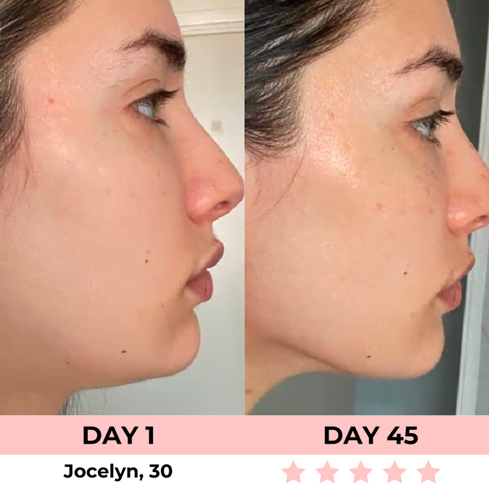 KC™ 7-in-1 LED Facial Sculptor